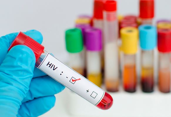 HIV vẫn là “bài toán khó” chưa có lời đáp